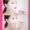 In& out facial Mask_K-09 B:VID In & Out 5pc Facial Pore Vacuum Suction Mask BVID 毛孔清洁面膜 控油去黑头粉刺
