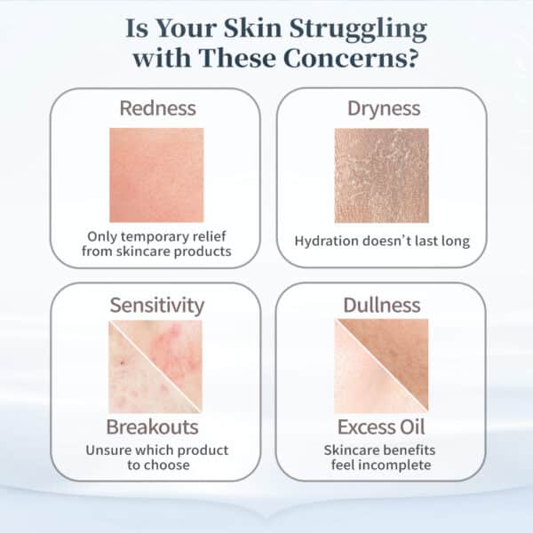 美肌菌補水面膜詳情頁-英文版_02 PSK Skincare & Makeup|Probiotic Intense Hydrating Mask | Hydrating Mask 4s